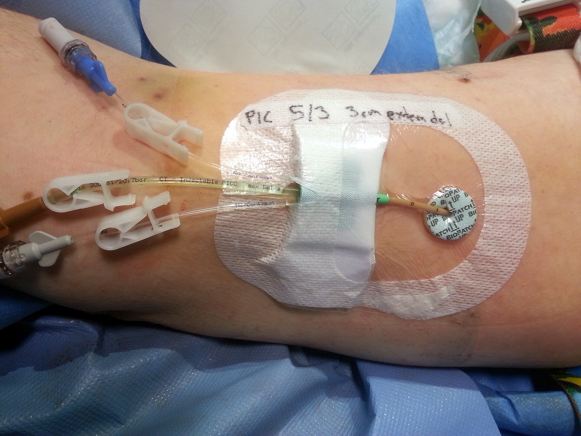 PICC Line
